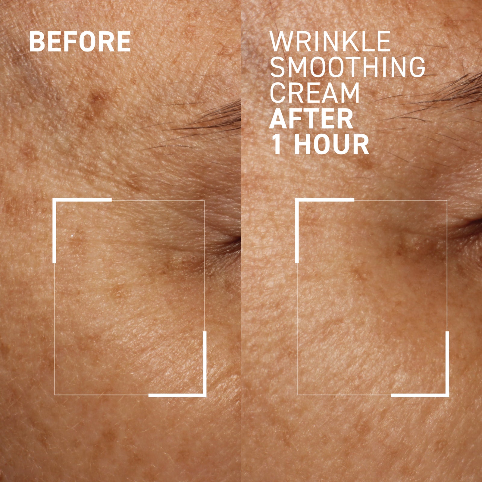 Wrinkle Smoothing Cream