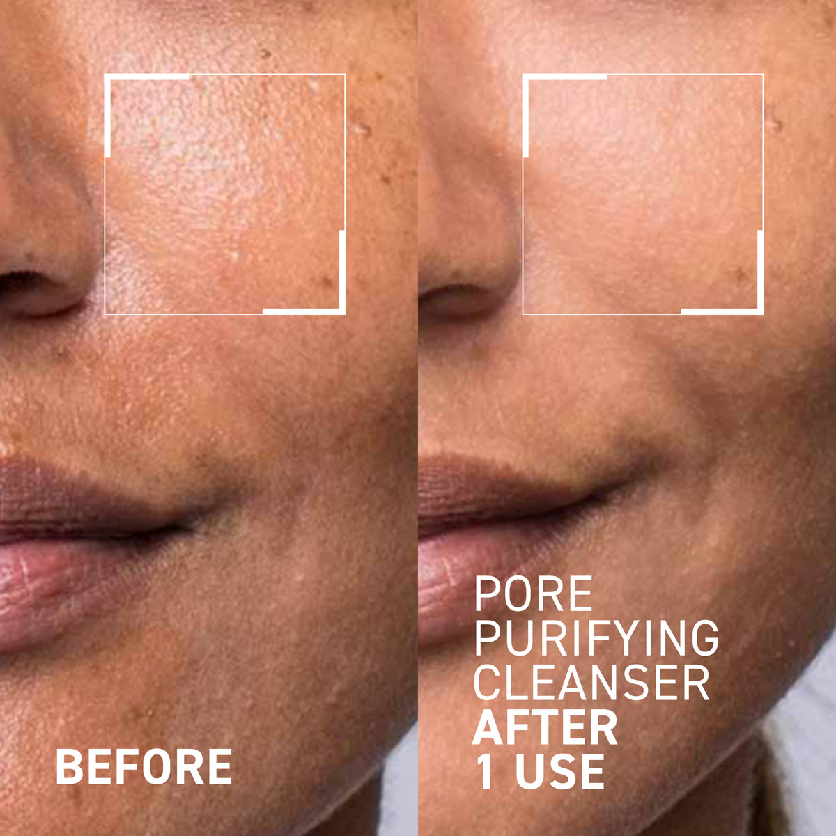 PORE PURIFYING CLEANSER